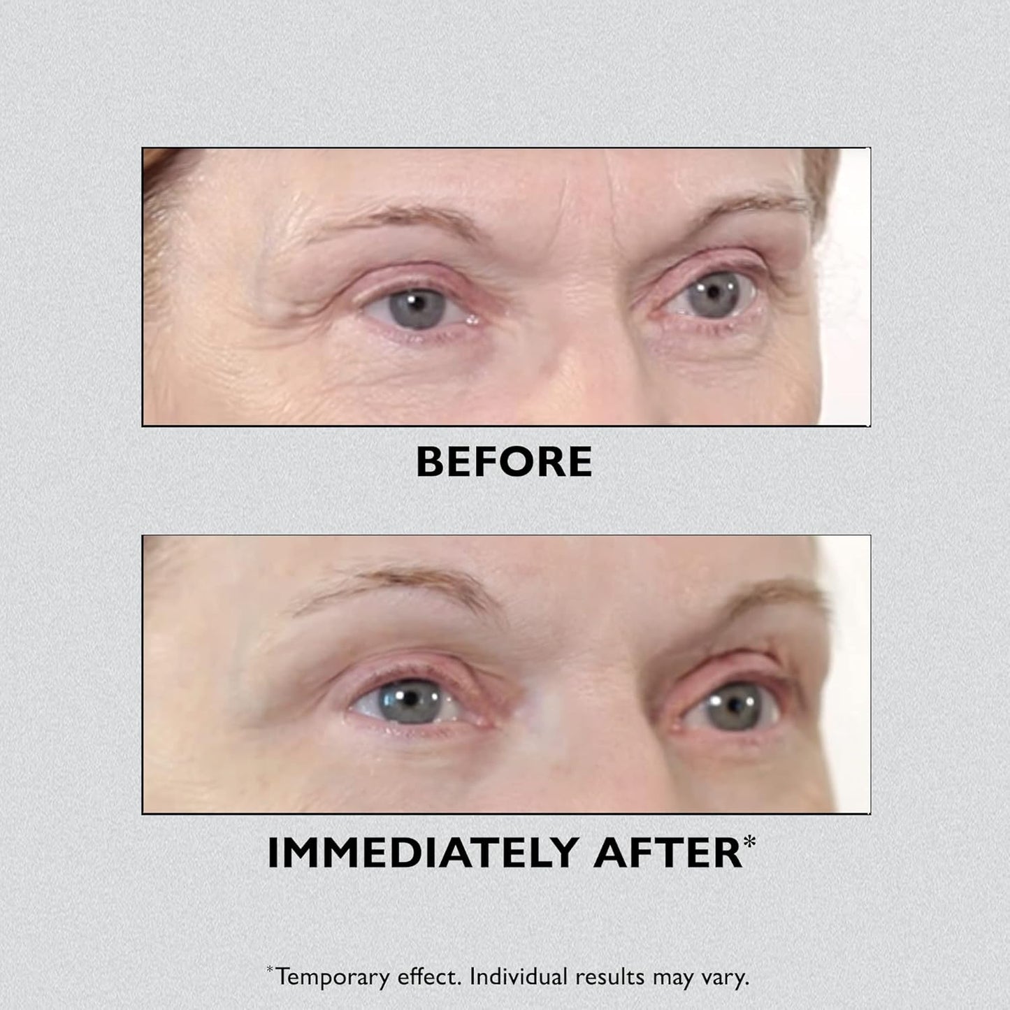 Instant Eye Lift Pro