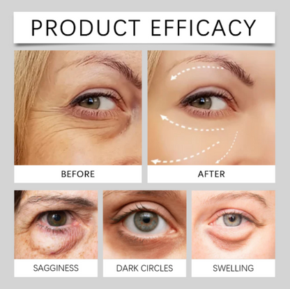 Instant Eye Lift Pro